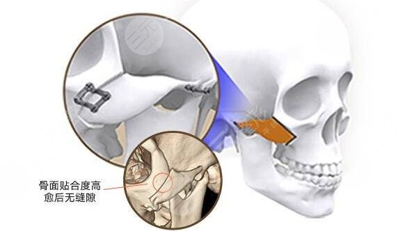 八大處正頜面部整形好的醫(yī)生