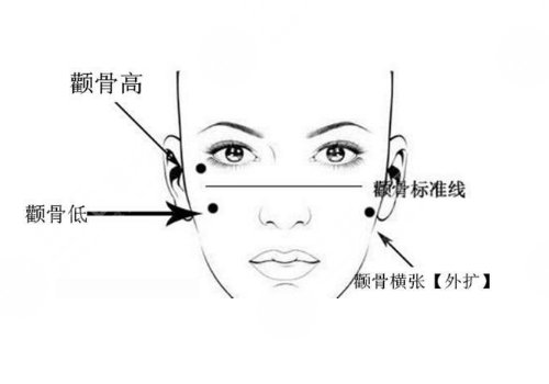 武汉亚韩整形医院做颧弓怎么样