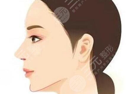  How about bone grinding in Shenyang Xinglin Plastic Surgery Hospital