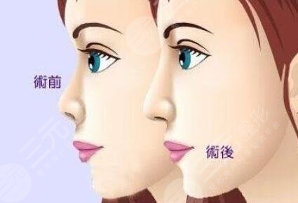  How about Beijing Wall Plastic Surgery Hospital