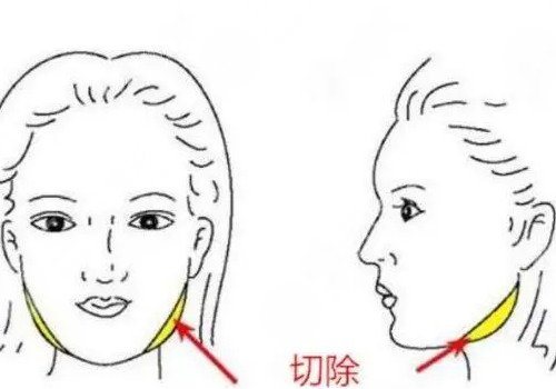  Shanghai Shiguang Plastic Maxillofacial Surgery