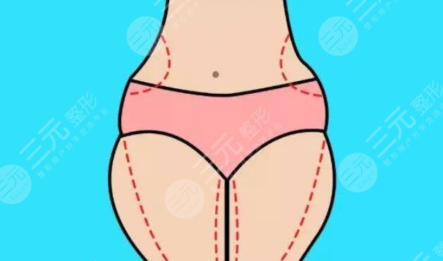  How about Nanjing Jiayimei liposuction