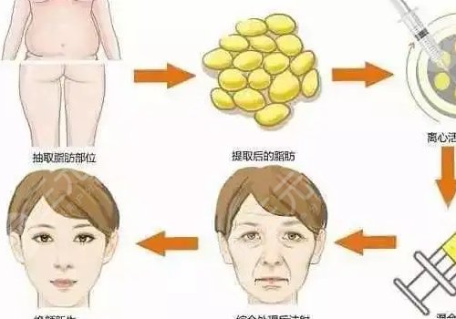  How about skin pulling in Chongqing Xingrong Plastic Surgery Hospital