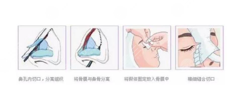 深圳瑞芙臣医疗美容是正规机构吗