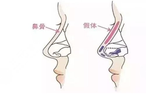 成都恒博天姿醫(yī)療美容怎么樣