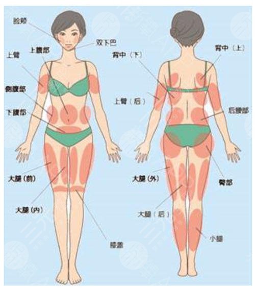  How about Changsha Meiyan liposuction