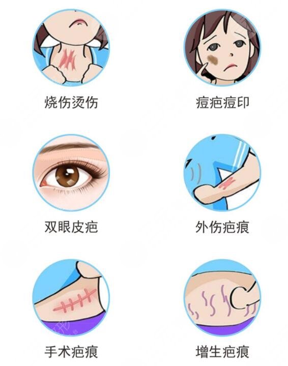 像素激光去疤痕要做多少次才能好有效果