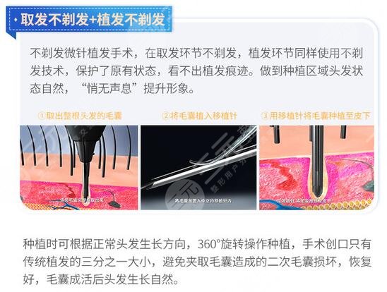 熙朵和大麥哪個好