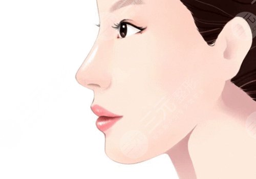  How about nose augmentation in Chengdu Third People's Hospital