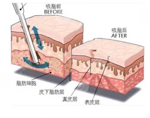 中山大學附屬第五醫(yī)院整形科怎么樣