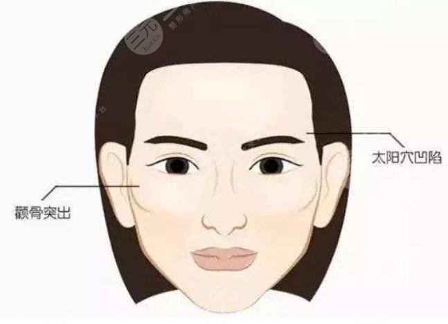 杭州连天美医疗美容医院做下颌削骨小脸吗