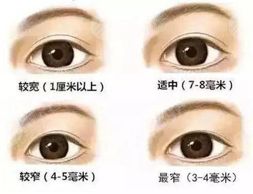  How about eyelid repair in Peking University First Hospital