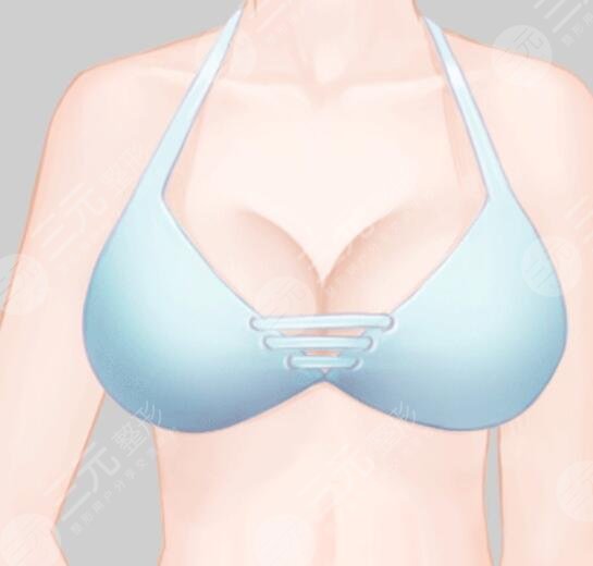  How about breast augmentation in Xi'an Milan Boyu Medical Beauty Hospital