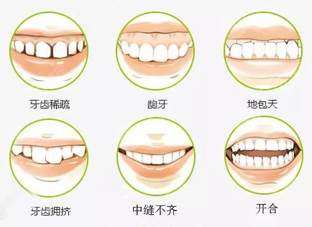 穗华口腔做根管治疗多少钱