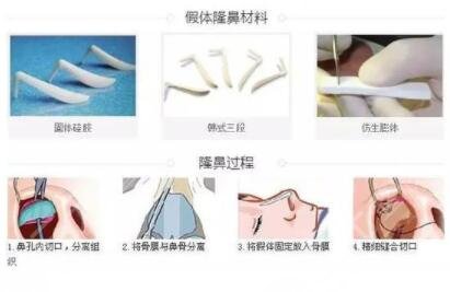  How about Shanghai Huamei Medical Beauty and Plastic Surgery Hospital